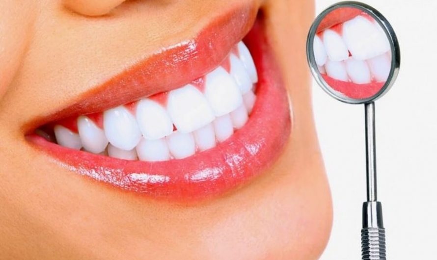 Отбеливание зубов: Новые подходы к сохранению белизны зубов
